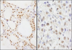NIF1 Antibody, Novus Biologicals 0.1mg; Unlabeled:Antibodies, Polyclonal